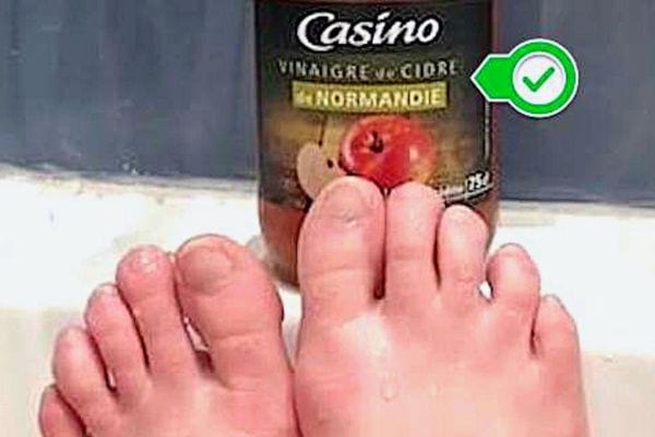 Des pieds avec une bouteille de vinaigre de cidre en fond