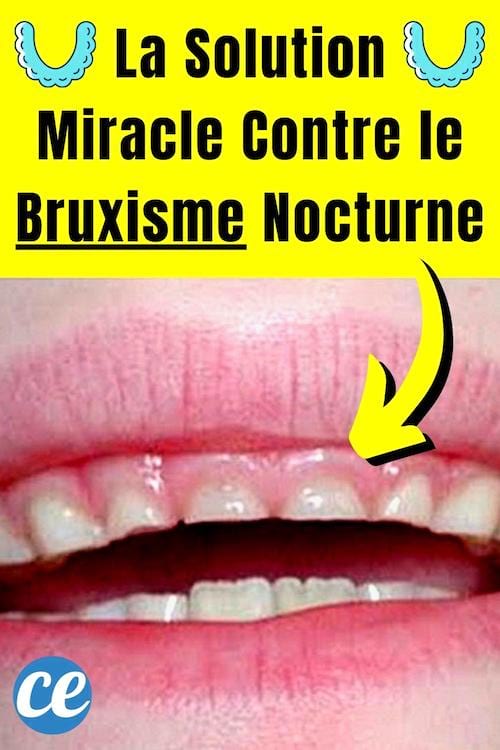 Des dents toutes abîmées à cause du bruxisme nocturne