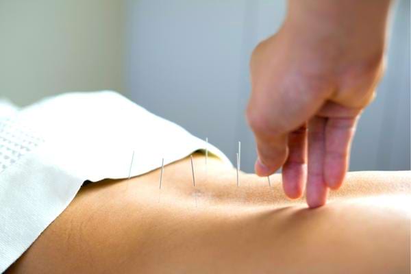 De l'acupuncture pour soulager une crise d'asthme sans médicaments