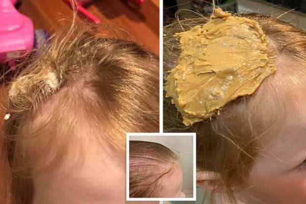 Du beurre de cacahuète dans les cheveux d'une petite fille 