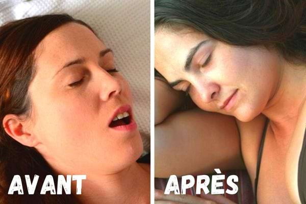 Une femme qui ronfle dans son sommeil avant après