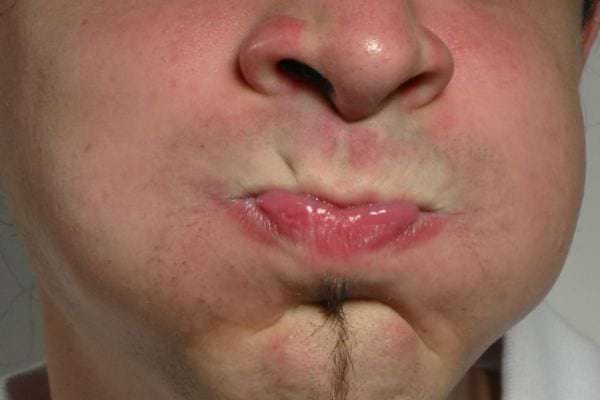 Un homme qui à la bouche remplie d'eau 