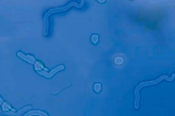 Les corps flottants ne disparaissent pas complètement avec le temps.