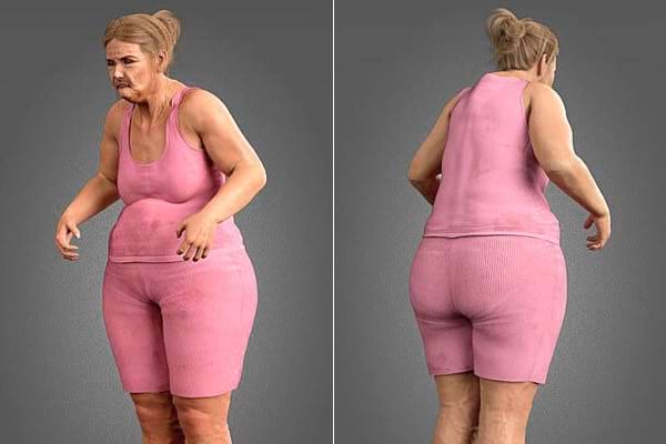 Une femme en télétravail qui est grosse et bossue