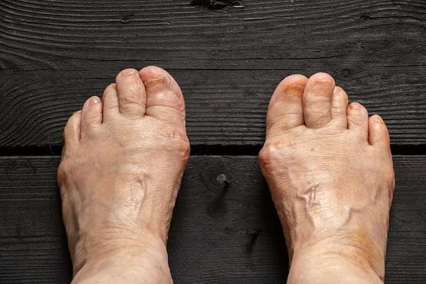 Des pieds assez épais