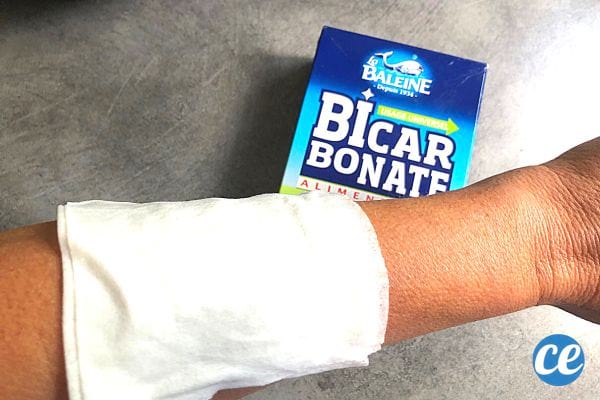 Une personne ayant un mouchoir posé sur son bras avec un carton de bicarbonate de soude 