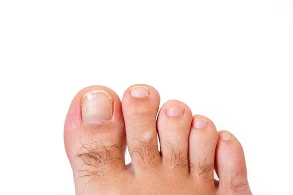 Un pied avec des orteils remplis de poils