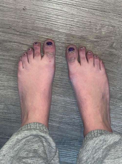 Des pieds avec du vernis violet sur les ongles