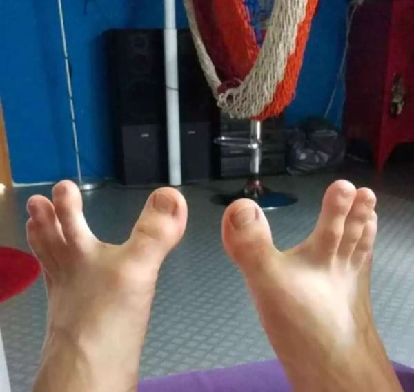 Des pieds blancs avec des orteils beaucoup écartés