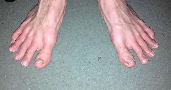Des pieds avec des longs orteils