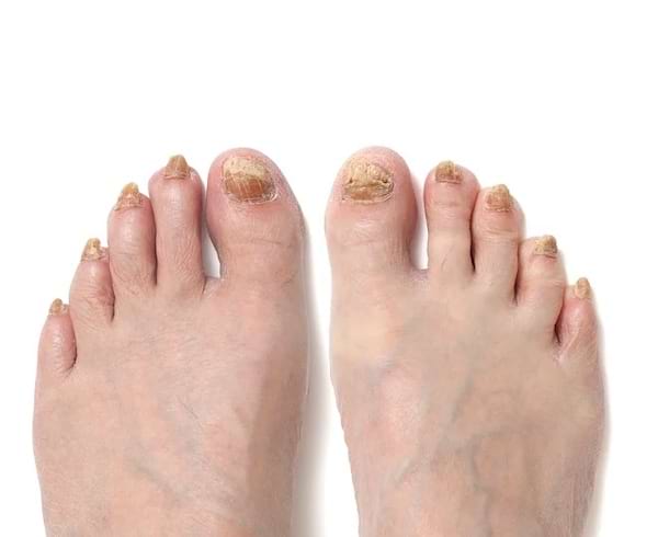 Des pieds avec des ongles pointus