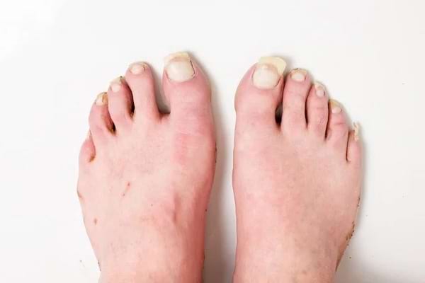 Des pieds avec des orteils et des ongles longs