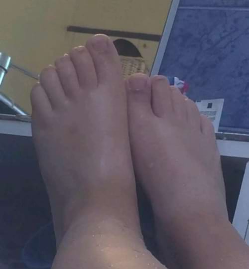 Des pieds blancs avec des orteils épais