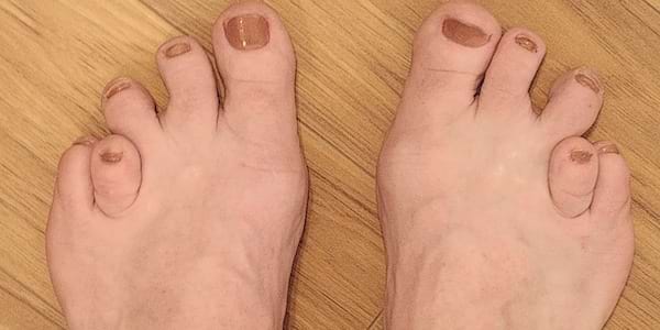 Des pieds avec des petits orteils
