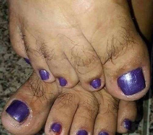 Des pieds avec du vernis violet sur les ongles et beaucoup de poils sur les orteils