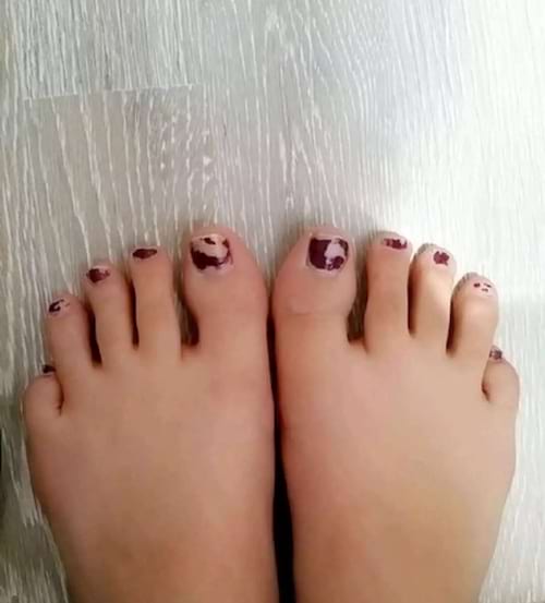 Des pieds avec du vernis violet écaillés