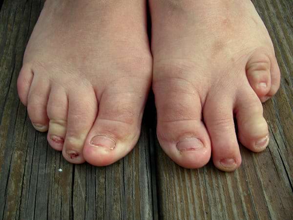 Des pieds avec des petits orteils