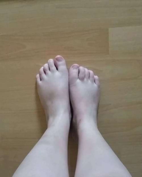 Des pieds avec un qui est plus grand que l'autre
