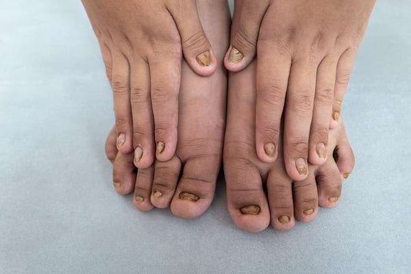 Des pieds foncés avec des ongles noirs