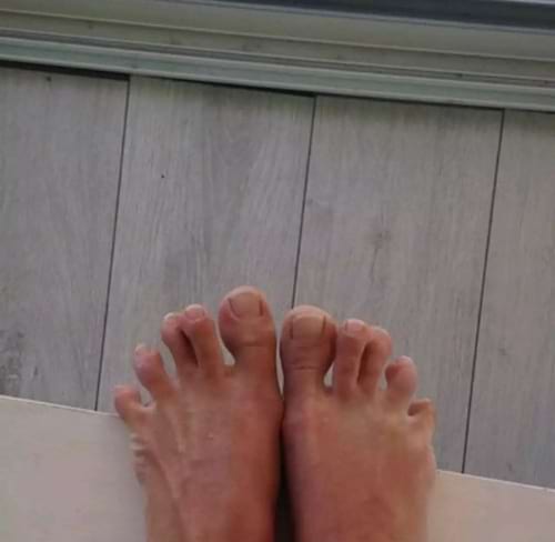 Des pieds blancs avec des gros orteils