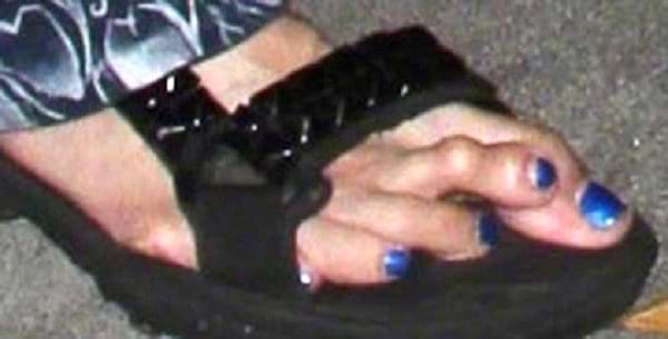 Un pied blanc avec du vernis bleus sur les ongles dans une chaussure ouverte noire