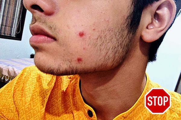Le visage d'un homme contenant deux boutons rouges
