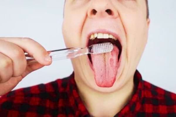 Un homme qui se brosse la langue pour soigner sa langue fissurée