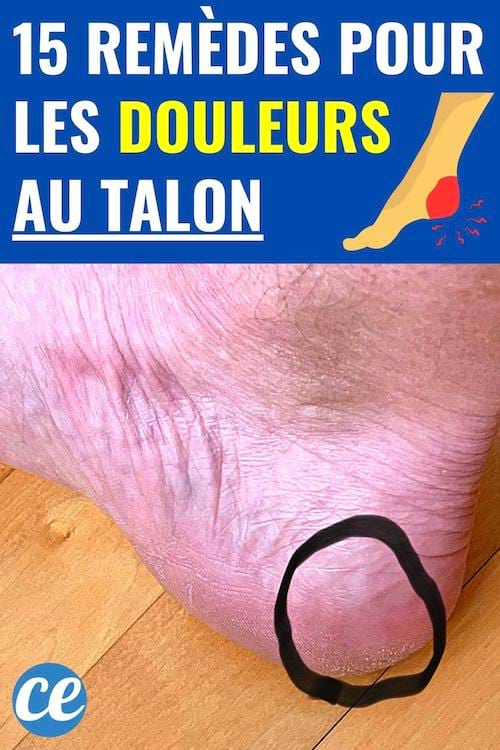Un talon de pied qui a des douleurs fortes et des remèdes pour le soigner