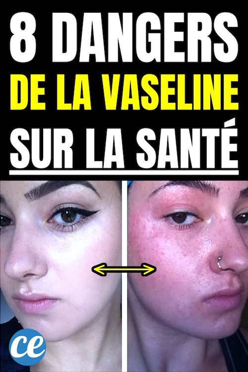 Vaseline : Les 8 Dangers Méconnus Pour la Santé.