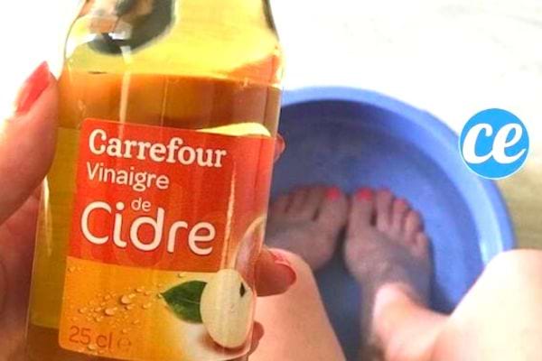 bain de pied au vinaigre de cidre anti douleur