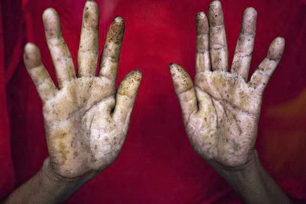 Une personne avec un haut rouge ayant une intoxication à l’arsenic