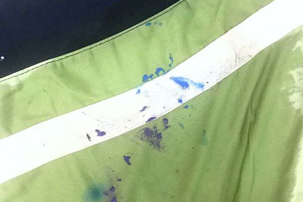 Blaue Flecken auf grüner Kleidung