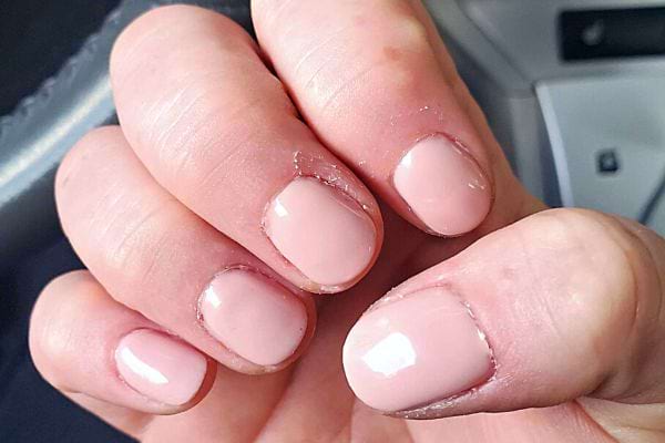 Taches Blanches Sur Les Ongles Causes Et Rem Des