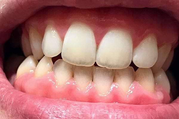 La bouche souriante zoomer d'une personne