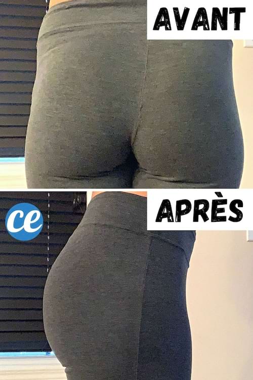 Avant après exercice hanche 
