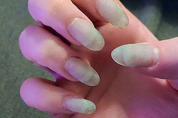 Ongles courts et rosés montrant une faiblesse structurelle sur une main à la peau claire.
