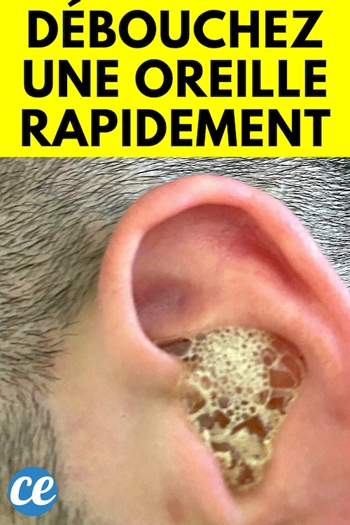 Oreille Bouchée 10 Remèdes Naturels Pour la Déboucher Rapidement.