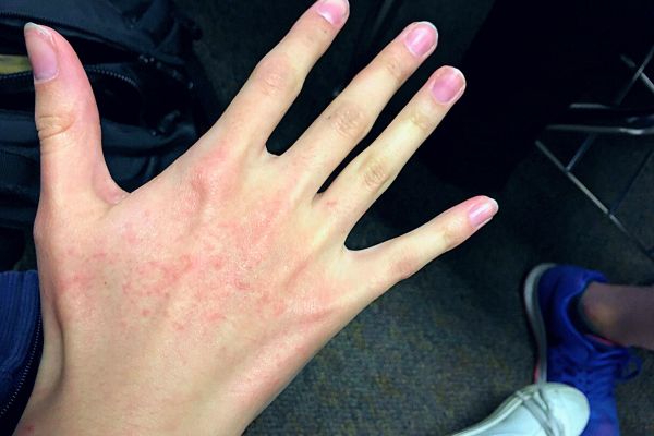 Main Droite Qui Gratte : Faut-il S'inquiéter ? Les 4 Significations