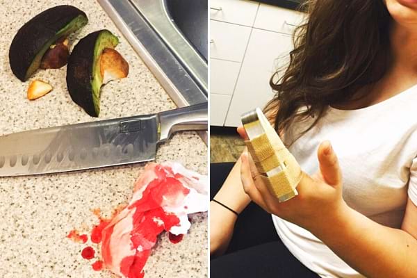 Une fille qui s'est coupé un doigt avec un couteau et un avocat