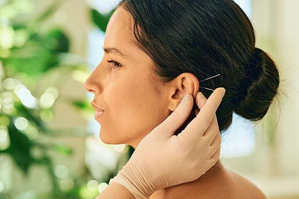 Praticienne insérant délicatement une aiguille d'