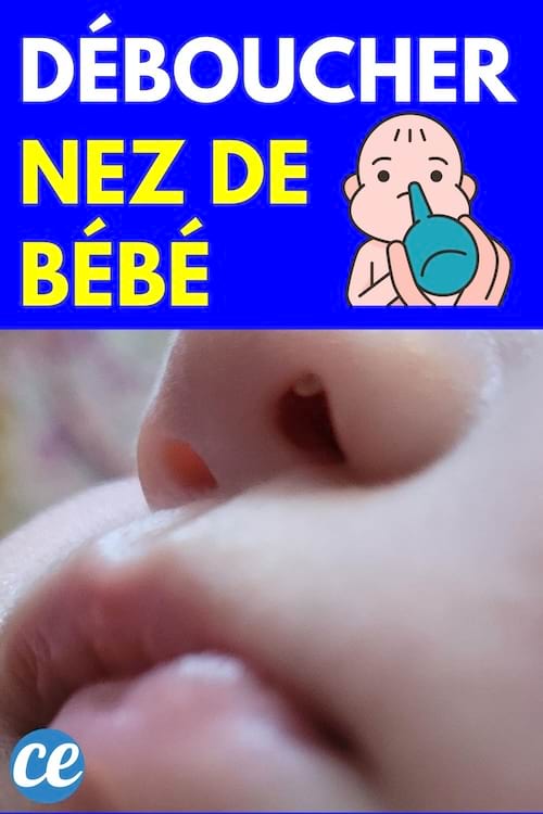 D&eacute;boucher Nez de B&eacute;b&eacute; 