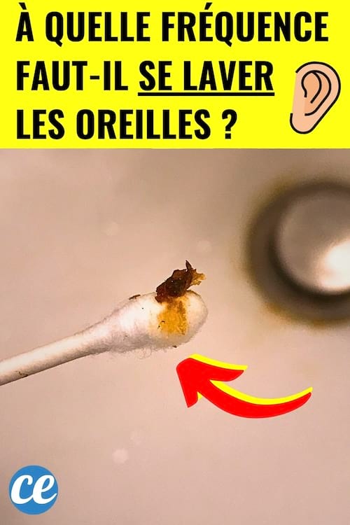 Un coton tige avec de la cerumen d'une oreille qui était sale