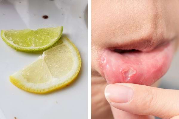 Citron vert et jaune en quartiers; femme tenant sa lèvre, douleur apparente.