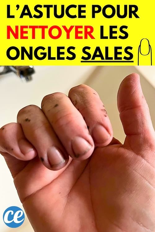 Ongles Sales Pleins de Saletés ? L