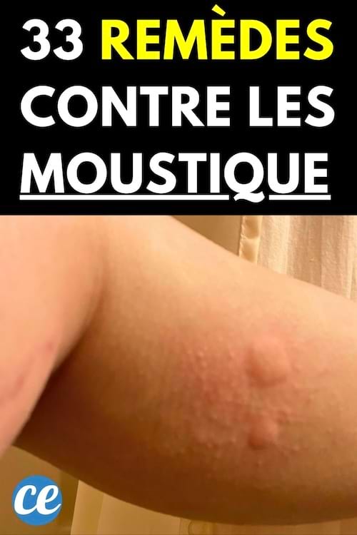 Piqûres de moustique sur bras 