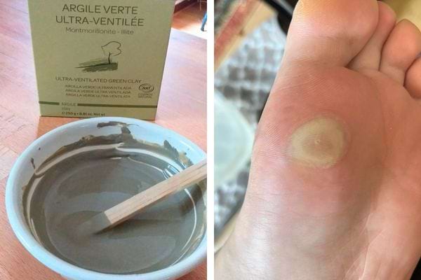 Argile verte dans un bol et ampoule sous le pied.