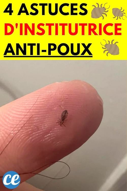 Un poux sur un doigt