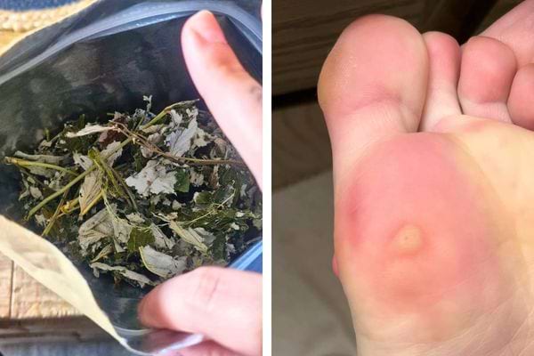 Feuilles séchées et rougeur sur le pied.