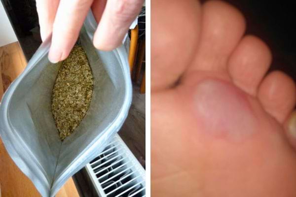 Herbes séchées et ampoule au pied.