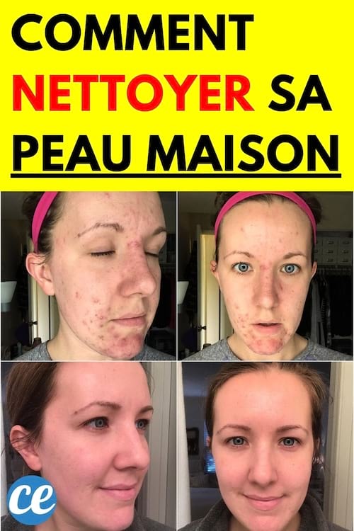 Femme avec bouton et ensuite sans bouton